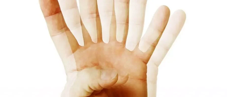 آستیگمات چیست؟