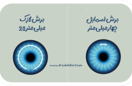 عمل اسمایل چشم