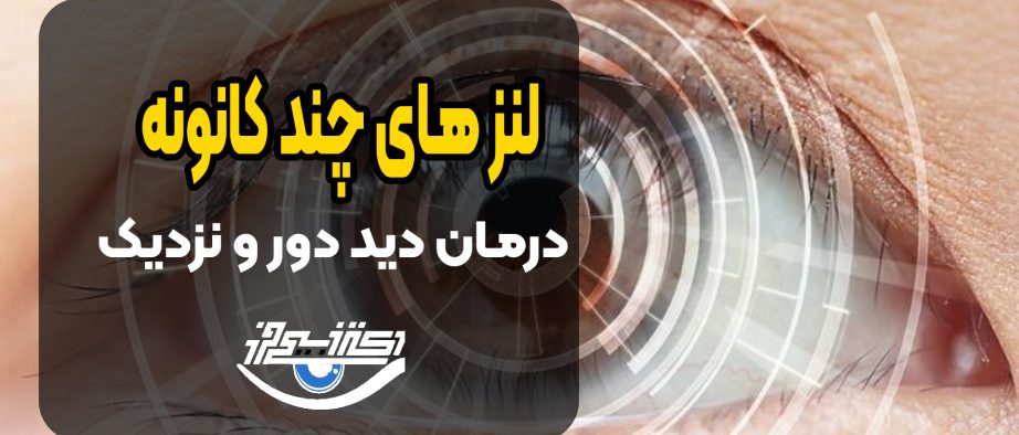 لنزهای مولتی‌فوکال در عمل کاتاراکت