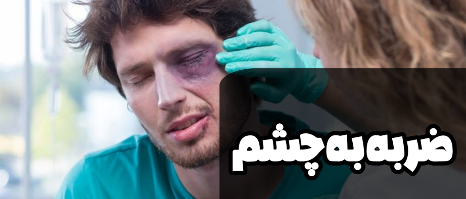 ضربه به چشم